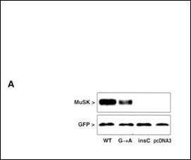 MUSK Antibody - MuSK protein expression in extracts of COS cells after transfection with MuSK mutated and GFP constructs. WB with polyclonal MuSK and monoclonal GFP antibodies showed normal expression of the wild-type MuSK protein (WT), diminished expression of the GA mutant MuSK and no expression of the insC mutant or the pcDNA3 vector alone in transfected COS cells. GFP cotransfection was used to verify transfection efficiency.