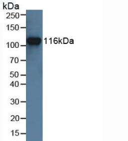 MUSK Antibody - Western Blot; Sample: Human Jurkat Cells.