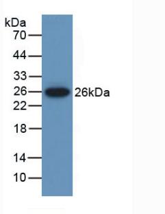 MUSK Antibody - Western Blot; Sample: Recombinant MUSK, Mouse.