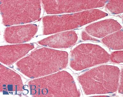 MUSK Antibody - Human Skeletal Muscle: Formalin-Fixed, Paraffin-Embedded (FFPE)