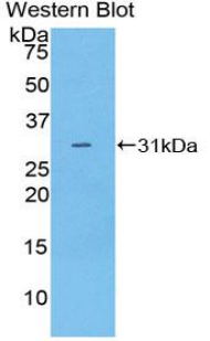 MUSK Antibody - Western blot of recombinant MUSK.  This image was taken for the unconjugated form of this product. Other forms have not been tested.