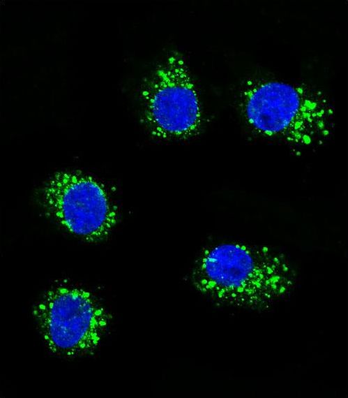 MUSK Antibody - Confocal immunofluorescence of MUSK Antibody with MDA-MB231 cell followed by Alexa Fluor 488-conjugated goat anti-rabbit lgG (green). DAPI was used to stain the cell nuclear (blue).