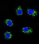 MUSK Antibody - Confocal immunofluorescence of MUSK Antibody with MDA-MB231 cell followed by Alexa Fluor 488-conjugated goat anti-rabbit lgG (green). DAPI was used to stain the cell nuclear (blue).