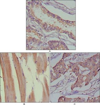 MUSK Antibody - MUSK Antibody in Immunohistochemistry (IHC)