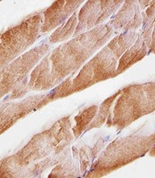 MUSK Antibody - Immunohistochemical of paraffin-embedded M. skeletal muscle section using Musk antibody diluted at 1:25 dilution. A undiluted biotinylated goat polyvalent antibody was used as the secondary, followed by DAB staining.