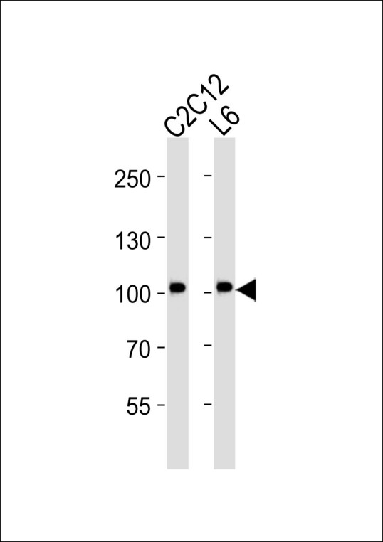 MUSK Antibody - Western blot of lysates from C2C12, L6 cell line (from left to right), using Musk antibody diluted at 1:2000 at each lane. A goat anti-mouse IgG H&L (HRP) at 1:3000 dilution was used as the secondary antibody. Lysates at 20 ug per lane.
