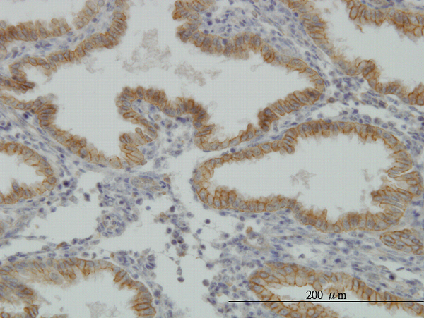 MUSK Antibody - Immunoperoxidase of monoclonal antibody to MUSK on formalin-fixed paraffin-embedded human endometrium. [antibody concentration 1 ug/ml]