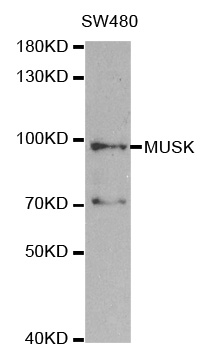 MUSK Antibody - Western blot analysis of extracts of SW480 cell line, using MUSK antibody.