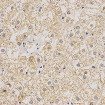 MUSK Antibody - Immunohistochemistry of paraffin-embedded human liver using MUSK antibody at dilution of 1:200 (x400 lens)