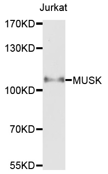 MUSK Antibody - Western blot analysis of extracts of Jurkat cells.