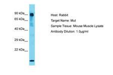 MUT / MCM Antibody -  This image was taken for the unconjugated form of this product. Other forms have not been tested.