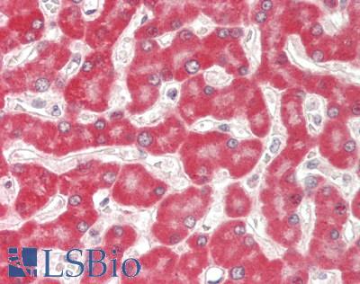 MUT / MCM Antibody - Human Liver: Formalin-Fixed, Paraffin-Embedded (FFPE)
