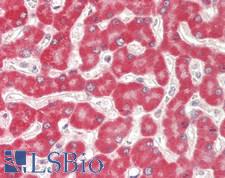 MUT / MCM Antibody - Human Liver: Formalin-Fixed, Paraffin-Embedded (FFPE)