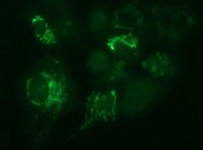 MUT / MCM Antibody - Anti-MUT mouse monoclonal antibody immunofluorescent staining of COS7 cells transiently transfected by pCMV6-ENTRY MUT.