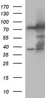 MUT / MCM Antibody - HEK293T cells were transfected with the pCMV6-ENTRY control (Left lane) or pCMV6-ENTRY MUT (Right lane) cDNA for 48 hrs and lysed. Equivalent amounts of cell lysates (5 ug per lane) were separated by SDS-PAGE and immunoblotted with anti-MUT.