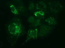 MUT / MCM Antibody - Anti-MUT mouse monoclonal antibody immunofluorescent staining of COS7 cells transiently transfected by pCMV6-ENTRY MUT.