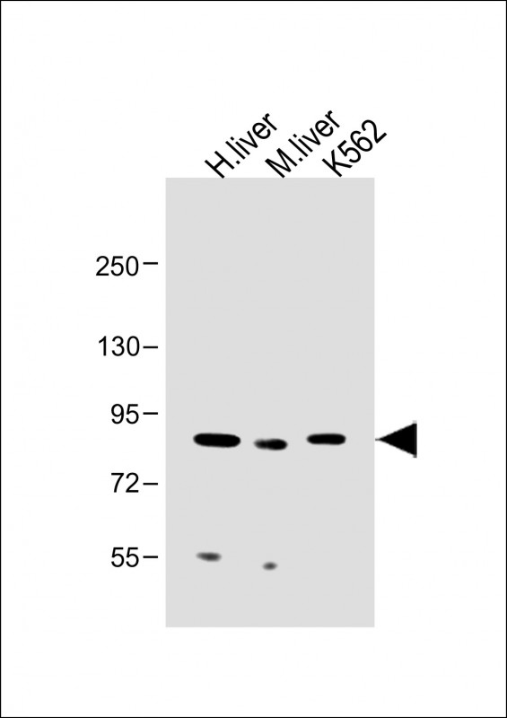 MUT / MCM Antibody - All lanes: Anti-MUT Antibody (Center) at 1:2000 dilution Lane 1: Human liver lysate Lane 2: Mouse liver lysate Lane 3: K562 whole cell lysate Lysates/proteins at 20 µg per lane. Secondary Goat Anti-Rabbit IgG, (H+L), Peroxidase conjugated at 1/10000 dilution. Predicted band size: kDa Blocking/Dilution buffer: 5% NFDM/TBST.