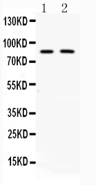 MUT / MCM Antibody - Western blot analysis of MUT expression in rat kidney extract (lane 1) and 22RV1 whole cell lysates (lane 2). MUT at 83KD was detected using rabbit anti-MUT Antigen Affinity purified polyclonal antibody at 0.5 µg/mL. The blot was developed using chemiluminescence (ECL) method.