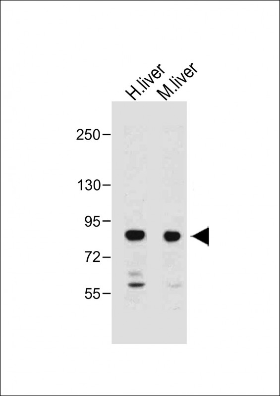 MUT / MCM Antibody - All lanes: Anti-MUT Antibody (N-Term) at 1:2000 dilution Lane 1: Human liver lysate Lane 2: Mouse liver lysate Lysates/proteins at 20 µg per lane. Secondary Goat Anti-Rabbit IgG, (H+L), Peroxidase conjugated at 1/10000 dilution. Predicted band size: 83 kDa Blocking/Dilution buffer: 5% NFDM/TBST.