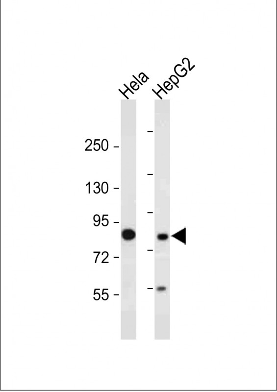 MUT / MCM Antibody - All lanes: Anti-MUT Antibody (N-Term) at 1:2000 dilution Lane 1: Hela whole cell lysate Lane 2: HepG2 whole cell lysate Lysates/proteins at 20 µg per lane. Secondary Goat Anti-Rabbit IgG, (H+L), Peroxidase conjugated at 1/10000 dilution. Predicted band size: 83 kDa Blocking/Dilution buffer: 5% NFDM/TBST.