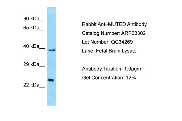 MUTED Antibody -  This image was taken for the unconjugated form of this product. Other forms have not been tested.