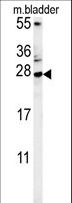 MUTED Antibody - MUTED Antibody western blot of mouse bladder tissue lysates (15 ug/lane). The MUTED antibody detected MUTED protein (arrow).