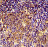 MUTED Antibody - MUTED Antibody immunohistochemistry of formalin-fixed and paraffin-embedded human tonsil tissue followed by peroxidase-conjugated secondary antibody and DAB staining.