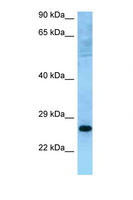 MUTED Antibody - MUTED antibody Western blot of HeLa Cell lysate. Antibody concentration 1 ug/ml.  This image was taken for the unconjugated form of this product. Other forms have not been tested.
