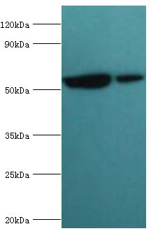 MUTYH / MYH Antibody - Western blot. All lanes: A/G-specific adenine DNA glycosylase antibody at 5 ug/ml. Lane 1: HeLa whole cell lysate. Lane 2: Jurkat whole cell lysate. Secondary antibody: Goat polyclonal to rabbit at 1:10000 dilution. Predicted band size: 60 kDa. Observed band size: 60 kDa.