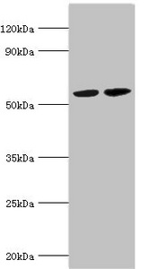 MUTYH / MYH Antibody - Western blot All lanes: A/G-specific adenine DNA glycosylase antibody at 5µg/ml Lane 1: Hela whole cell lysate Lane 2: Jurakt whole cell lysate Secondary Goat polyclonal to rabbit IgG at 1/10000 dilution Predicted band size: 61, 60, 59, 58 kDa Observed band size: 61 kDa