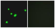 MUTYH / MYH Antibody - Immunofluorescence analysis of A549 cells, using MUTYH Antibody. The picture on the right is blocked with the synthesized peptide.