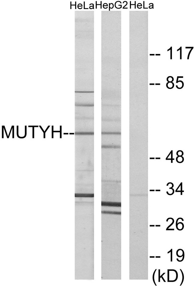 MUTYH / MYH Antibody - Western blot analysis of lysates from HeLa and HepG2 cells, using MUTYH Antibody. The lane on the right is blocked with the synthesized peptide.