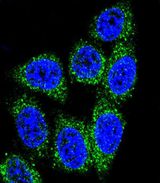 MUTYH / MYH Antibody - Confocal immunofluorescence of MUTYH Antibody with HeLa cell followed by Alexa Fluor 488-conjugated goat anti-rabbit lgG (green). DAPI was used to stain the cell nuclear (blue).