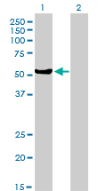 MUTYH / MYH Antibody - Western Blot analysis of MUTYH expression in transfected 293T cell line by MUTYH monoclonal antibody (M01), clone 4D10.Lane 1: MUTYH transfected lysate(59.1 KDa).Lane 2: Non-transfected lysate.