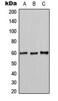 MUTYH / MYH Antibody - Western blot analysis of MUTYH expression in K562 (A); HL60 (B); NIH3T3 (C) whole cell lysates.