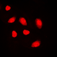 MUTYH / MYH Antibody - Immunofluorescent analysis of MUTYH staining in K562 cells. Formalin-fixed cells were permeabilized with 0.1% Triton X-100 in TBS for 5-10 minutes and blocked with 3% BSA-PBS for 30 minutes at room temperature. Cells were probed with the primary antibody in 3% BSA-PBS and incubated overnight at 4 C in a humidified chamber. Cells were washed with PBST and incubated with a DyLight 594-conjugated secondary antibody (red) in PBS at room temperature in the dark. DAPI was used to stain the cell nuclei (blue).