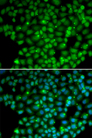 MUTYH / MYH Antibody - Immunofluorescence analysis of U20S cells.