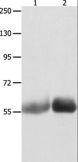 MUTYH / MYH Antibody - Western blot analysis of Human liver cancer and stomach cancer tissue, using MUTYH Polyclonal Antibody at dilution of 1:1000.