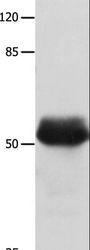 MUTYH / MYH Antibody - Western blot analysis of HeLa cell, using MUTYH Polyclonal Antibody at dilution of 1:500.
