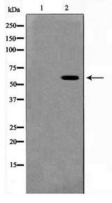MUTYH / MYH Antibody - Western blot of HeLa cell lysate using MUTYH Antibody