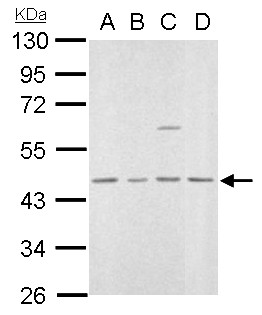 MVD Antibody - MVD antibody detects MVD protein by Western blot analysis. A. 30 ug 293T whole lysate/extract. B. 30 ug A431 whole cell lysate/extract. C. 30 ug HeLa whole cell lysate/extract. D. 30 ug A375 whole cell lysate/extract. 10 % SDS-PAGE. MVD antibody dilution:1:1000