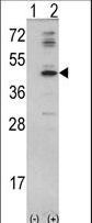 MVD Antibody - Western blot of MVD (arrow) using rabbit polyclonal MVD Antibody. 293 cell lysates (2 ug/lane) either nontransfected (Lane 1) or transiently transfected with the MVD gene (Lane 2).