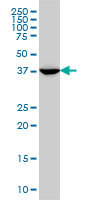 MVD Antibody - MVD monoclonal antibody (M01), clone 2A7 Western Blot analysis of MVD expression in A-431.