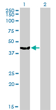 MVD Antibody - Western Blot analysis of MVD expression in transfected 293T cell line by MVD monoclonal antibody (M01), clone 2A7.Lane 1: MVD transfected lysate(43.4 KDa).Lane 2: Non-transfected lysate.
