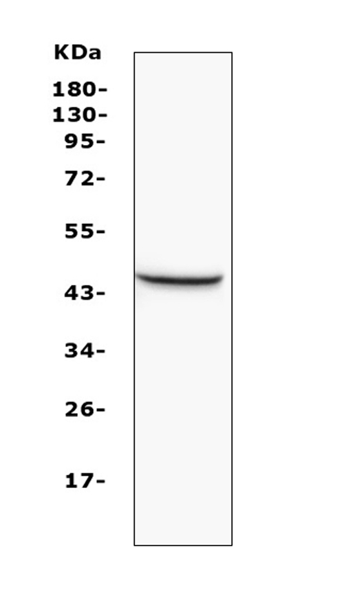 MVD Antibody - Western blot analysis of MVD using anti-MVD antibody. Electrophoresis was performed on a 5-20% SDS-PAGE gel at 70V (Stacking gel) / 90V (Resolving gel) for 2-3 hours. The sample well of each lane was loaded with 50ug of sample under reducing conditions. Lane 1: rat liver tissue lysates. After Electrophoresis, proteins were transferred to a Nitrocellulose membrane at 150mA for 50-90 minutes. Blocked the membrane with 5% Non-fat Milk/ TBS for 1.5 hour at RT. The membrane was incubated with rabbit anti-MVD antigen affinity purified polyclonal antibody at 0.5 µg/mL overnight at 4°C, then washed with TBS-0.1% Tween 3 times with 5 minutes each and probed with a goat anti-rabbit IgG-HRP secondary antibody at a dilution of 1:10000 for 1.5 hour at RT. The signal is developed using an Enhanced Chemiluminescent detection (ECL) kit with Tanon 5200 system. A specific band was detected for MVD at approximately 45KD. The expected band size for MVD is at 43KD.