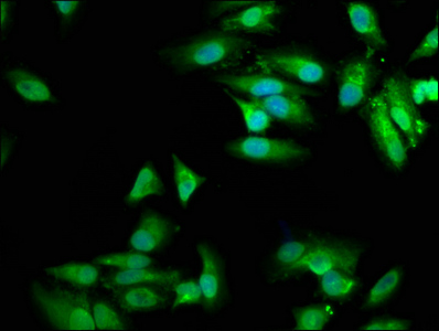 MVD Antibody - Immunofluorescence staining of Hela cells at a dilution of 1:100, counter-stained with DAPI. The cells were fixed in 4% formaldehyde, permeabilized using 0.2% Triton X-100 and blocked in 10% normal Goat Serum. The cells were then incubated with the antibody overnight at 4 °C.The secondary antibody was Alexa Fluor 488-congugated AffiniPure Goat Anti-Rabbit IgG (H+L) .