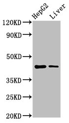 MVD Antibody - Positive Western Blot detected in HepG2 whole cell lysate, Rat liver tissue. All lanes: MVD antibody at 7.4 µg/ml Secondary Goat polyclonal to rabbit IgG at 1/50000 dilution. Predicted band size: 44 KDa. Observed band size: 44 KDa