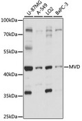 MVD Antibody - Western blot analysis of extracts of various cell lines, using MVD antibody at 1:1000 dilution. The secondary antibody used was an HRP Goat Anti-Rabbit IgG (H+L) at 1:10000 dilution. Lysates were loaded 25ug per lane and 3% nonfat dry milk in TBST was used for blocking. An ECL Kit was used for detection and the exposure time was 90s.
