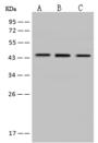 MVD Antibody - Anti-MVD rabbit polyclonal antibody at 1:2000 dilution. Lane A: HeLa Whole Cell Lysate. Lane B: K562 Whole Cell Lysate. Lane C: HepG2 Whole Cell Lysate. Lysates/proteins at 30 ug per lane. Secondary: Goat Anti-Rabbit IgG (H+L)/HRP at 1/10000 dilution. Developed using the ECL technique. Performed under reducing conditions. Predicted band size: 43 kDa. Observed band size: 45 kDa.