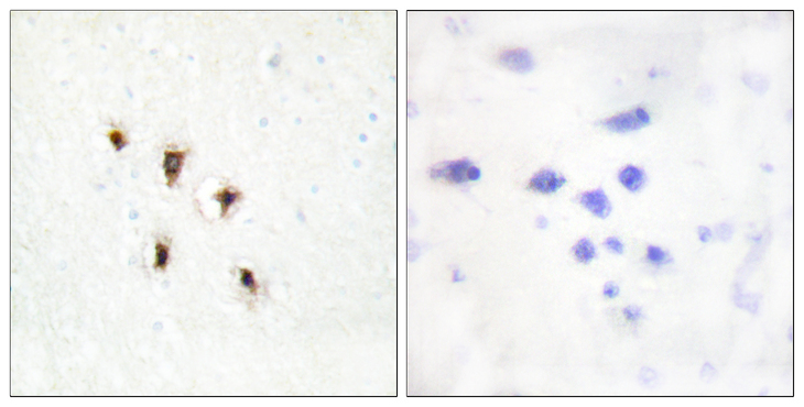 MVK Antibody - Immunohistochemistry analysis of paraffin-embedded human brain tissue, using Mevalonate Kinase Antibody. The picture on the right is blocked with the synthesized peptide.
